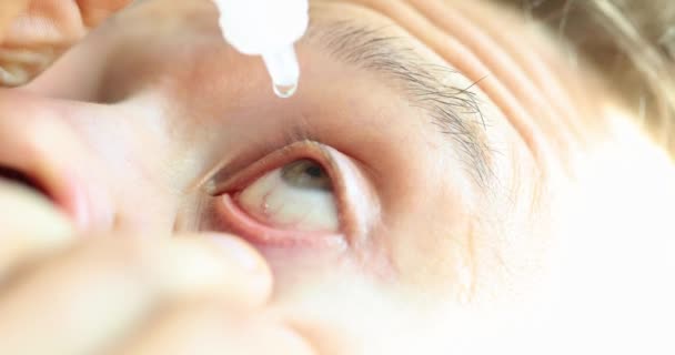 男は液体を滴下乾燥した目に落ちる。視力の問題を解決し、目の角膜をケア - 映像、動画
