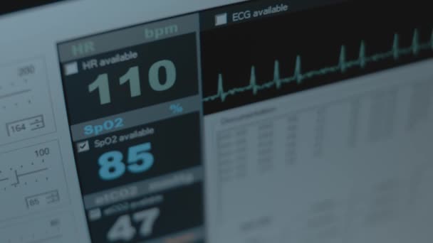 La visualizzazione ravvicinata dello schermo del monitor paziente mostra segni vitali elettrocardiogramma ECG ECG e saturazione di ossigeno SPO2. - Filmati, video