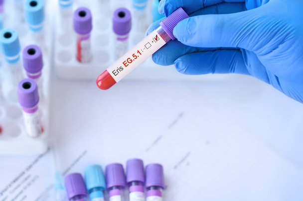 Médico segurando um tubo de amostra de sangue teste para a detecção da nova variante Omicron Eris EG.5.1 no fundo de tubos de ensaio médicos. - Foto, Imagem