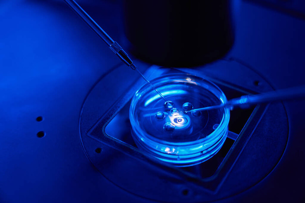 精子マトゾンはマイクロニードルの助けを借りて卵巣に注入され,顕微鏡の下でピペットを保持しています - 写真・画像
