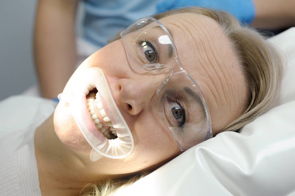 nő fogászati székben optragikus szájfeltéteszáj tartja ajkak fogászati eljárások átlátszó szemüveg kinyitja és becsukja száj grimaszok, hogy az arcok mosolygós vidám fogászat vicces közelkép - Fotó, kép