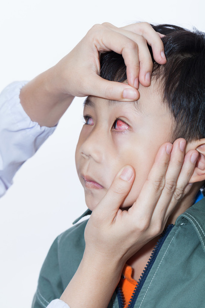 Pinkeye (Bindehautentzündung) Infektion bei einem Jungen, Arzt untersucht Auge - Foto, Bild
