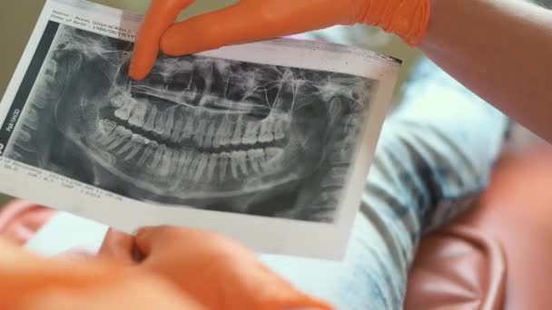 Dentysta pokazuje prześwietlenie szczęki klientowi w klinice. - Materiał filmowy, wideo