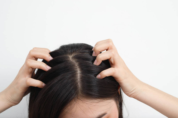 Egy nőnek problémái vannak a hajjal és a fejbőrrel, korpás a samponokra adott allergiás reakcióktól. és hajkondicionáló - Fotó, kép