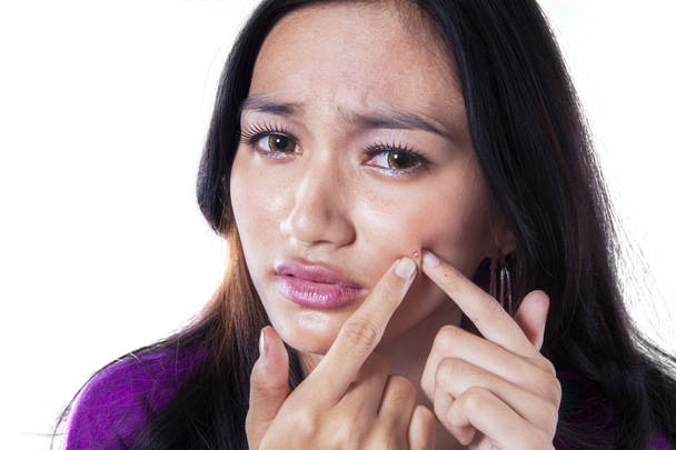 Young girl cleaning pimple on her face - Photo, image
