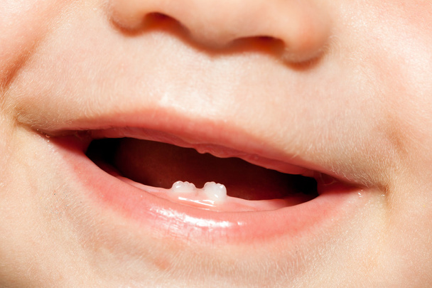 Gyermek első két fogak közelről - Fotó, kép