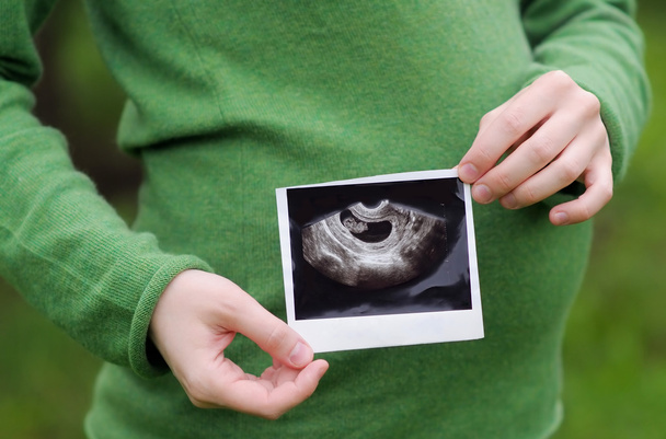 Ultrasound photographs of pregnancy - Foto, Bild
