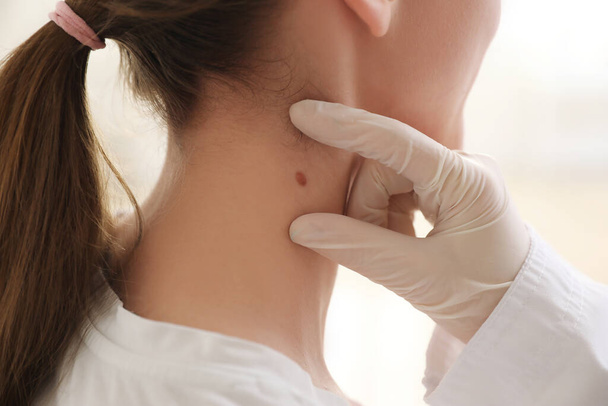 Dermatologist examining mole on young woman's neck in clinic, closeup - Photo, Image