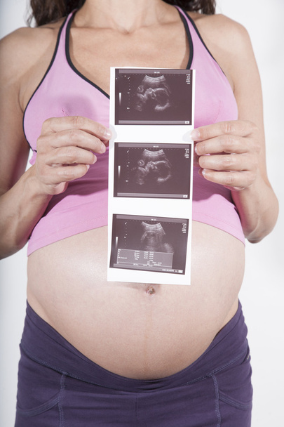 вагітна з ультразвуковим скануванням дитини
 - Фото, зображення