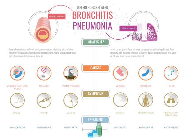 Відмінності між бронхітом і пневмонією, причини, симптоми і різні методи лікування, всі позначені відповідними іконками. - Вектор, зображення