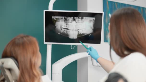 Hammaslääkäri näyttää naisen röntgenkuvat hampaistaan yksityiskohtaista tutkimusta varten. Hammaslääkäri käyttää panoraama tomografia tarkasti diagnosoida ongelmia suuonteloon. Laadukas 4k kuvamateriaalia - Materiaali, video