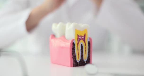 Dottore mette le mani sui lati del modello artificiale dei denti rendendo protezione. Importante professione di ortodontista e studio della struttura dei denti umani rallentatore - Filmati, video