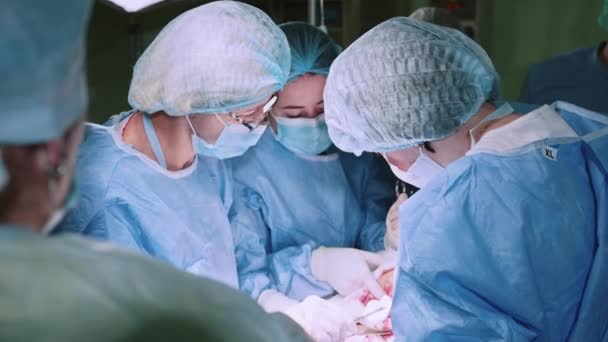Orvos Műtétet végez sterilizált felszereléssel. A sebészcsapat sebészeti beavatkozást hajt végre. Nőgyógyászok és szülésznők szülnek. Csecsemő a szülészeten. Isten hozott az anyaságban. - Felvétel, videó