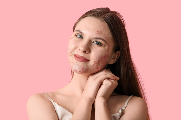 Mujer joven con problemas de acné sobre fondo rosa, primer plano - Foto, imagen