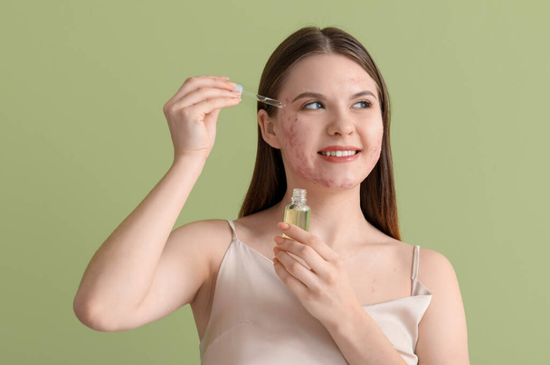 Young woman with acne problem applying serum on green background, closeup - Fotografie, Obrázek