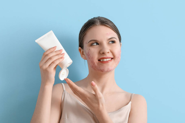 jonge vrouw met acne probleem en buis van crème op blauwe achtergrond, close-up - Foto, afbeelding