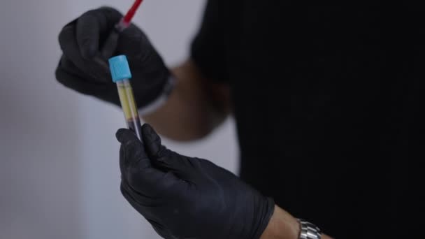 Οι γιατροί χειρίζονται το σωλήνα με prp του αίματος - 4K Οριζόντια βίντεο - Πλάνα, βίντεο