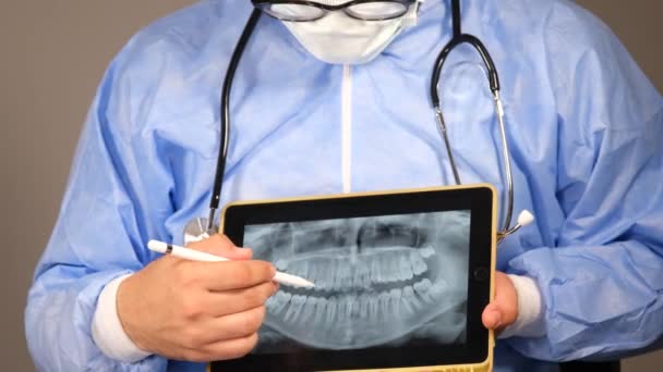 fogászati röntgen, orvos mutatja fogászati röntgen tablettával - Felvétel, videó