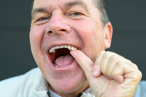 Extremo acercamiento de un hombre sin su prótesis dental delante y sosteniendo la prótesis en el negro - Foto, imagen