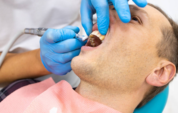 Close-up do uso de broca dentária para os dentes dos pacientes no consultório odontológico em um procedimento de tratamento odontológico
 - Foto, Imagem
