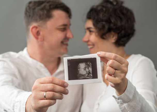 Una mujer embarazada y su marido tienen en sus manos una foto de su futuro bebé recién nacido. Embarazo, maternidad - Foto, imagen