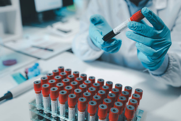 Bir kimyager test tüpündeki kandaki kimyasalları araştırmak için mikroskop kullanıyor, Kimyager test tüplerini kimyasal olarak analiz ediyor, bilim adamı laboratuvarda kimyasallarla deney yapıyor.,  - Fotoğraf, Görsel