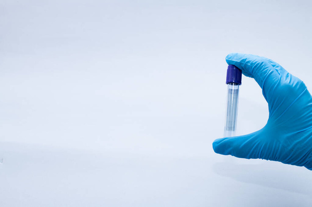 Próżniowa rurka do pobierania krwi z cytrynianem sodu w niebieskich rękawiczkach do laboratorium. - Zdjęcie, obraz