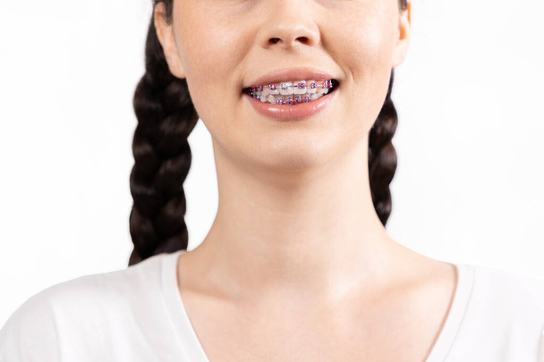 Close-up of smiling young woman with braces on her teeth. White background. Concept of orthodontic treatment. - Фото, зображення