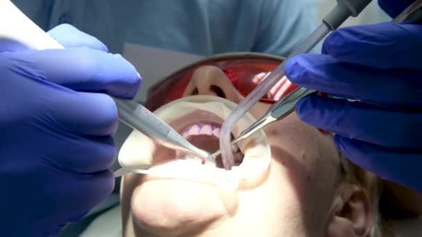 Два врача, мужчина и женщина в защитных масках в стоматологической клинике, обслуживают пациентку. Рабочий дантист. Здравоохранение и медицина. Высококачественные 4k кадры - Кадры, видео