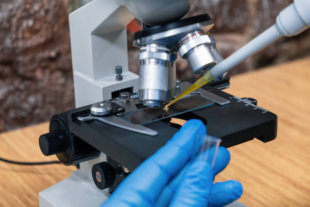 Γιατρός στάζει ούρα από μια πιπέτα πάνω σε γυαλί στο μικροσκόπιο για να ελέγξει για ουρολιθίαση. Τεστ ούρων σε ιατρικό εργαστήριο. Ανίχνευση ασθενειών του ουροποιητικού συστήματος με την εκτέλεση χημικών ουσιών - Φωτογραφία, εικόνα