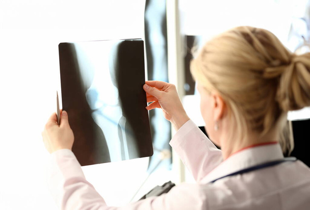 Radiolog femelle tenant dans les mains des images de films radiographiques aganiste fond de bureau de l'hôpital. CT scans de santé osseuse concept
. - Photo, image