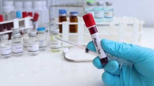 Test de peste pour rechercher des anomalies du sang, expérience scientifique - Séquence, vidéo
