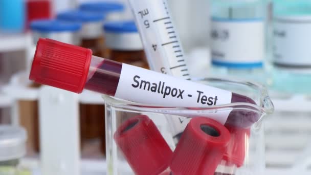 Isorokko testi etsiä poikkeavuuksia verestä, tieteellinen kokeilu - Materiaali, video