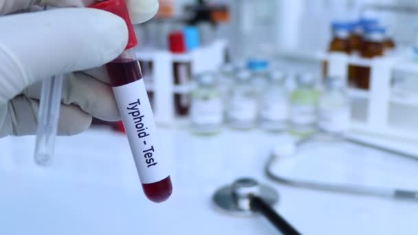 Τυφοειδής δοκιμή για να ψάξουν για ανωμαλίες από το αίμα, επιστημονικό πείραμα - Πλάνα, βίντεο