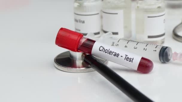 Cholerae test om te zoeken naar afwijkingen van bloed, wetenschappelijk experiment - Video