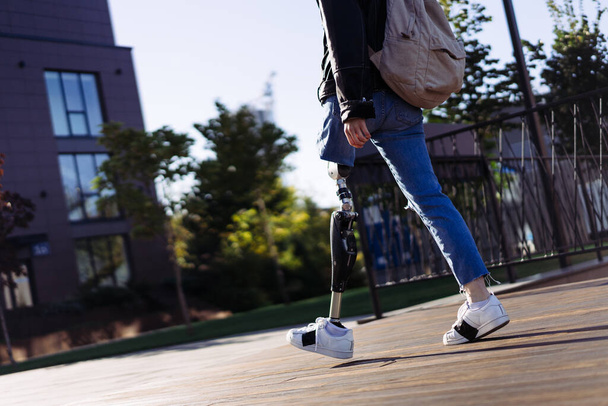 Közelkép egy női diákról, akinek műlába van, és az egyetemen sétál. Egy bionikus lábú nő. Nő lábprotézis berendezés. - Fotó, kép