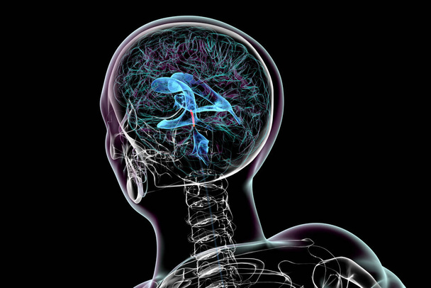 Мозковий акведук (відзначений помаранчевим кольором), вузький канал у мозку, що з'єднує третій і четвертий шлуночки, полегшуючи потік спинномозкової рідини, 3D ілюстрація. - Фото, зображення