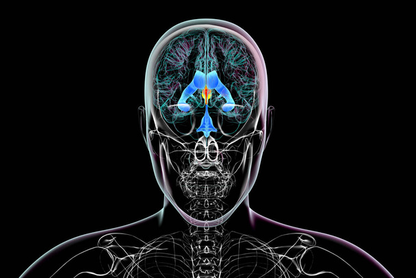 Una ilustración científica en 3D que representa el agrandamiento aislado del tercer ventrículo cerebral, vista frontal. - Foto, Imagen