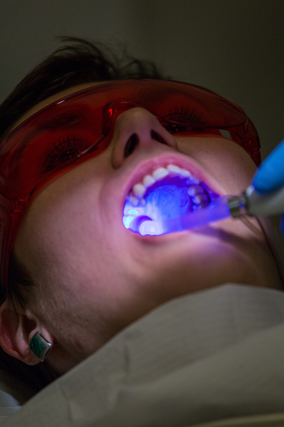 Getting braces on teeth - Φωτογραφία, εικόνα