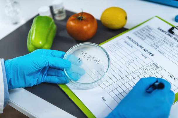 Valutazione della qualità degli alimenti nel laboratorio di microbiologia, moduli di riempimento per microbiologi, secondo la procedura operativa standard  - Foto, immagini