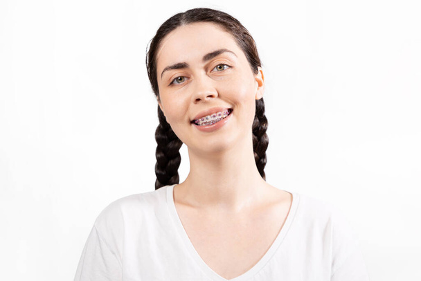 Porträt einer lächelnden kaukasischen jungen Frau mit Zahnspange. Weißer Hintergrund. Konzept der kieferorthopädischen Behandlung und Zahnheilkunde. - Foto, Bild