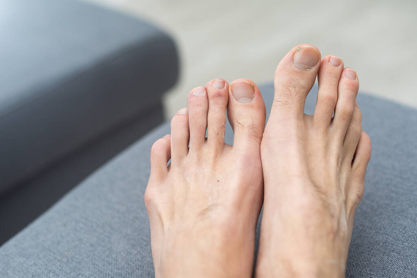 Νεαρό λευκό τριχωτό πόδι με νύχια ποδιών χωρίς φροντίδα. - Φωτογραφία, εικόνα