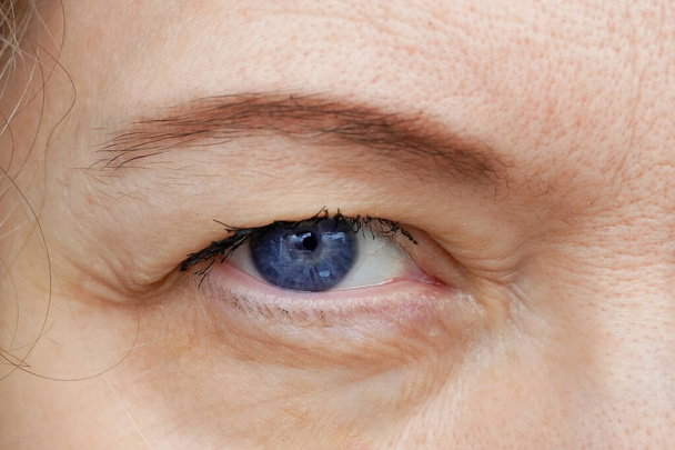Keski-ikäisen naisen silmä roikkuvat silmäluomet tekevät kulmakarvojen meikkiä. Ptoosi on ylemmän silmäluomen roikkuminen, laiska silmä. Kosmetologia ja kasvojen käsite, ensimmäinen ryppyjä, lähikuva - Valokuva, kuva