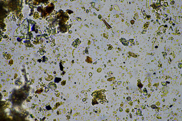 půdní mikroorganismy se uzavírají pod mikroskopem. v půdě z farmy - Fotografie, Obrázek