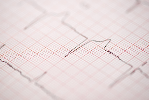 Electrocardiograma - Foto, Imagen