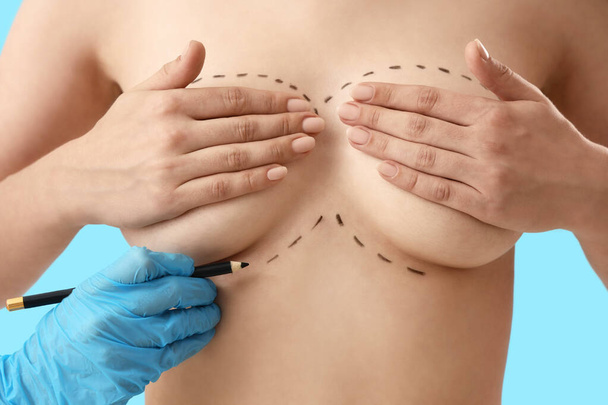 Plastic surgeon drawing marks on female breast before operation against blue background, closeup - Photo, Image