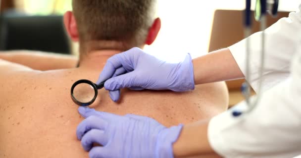 Doctor oncologist examining patient pigmented nevi with magnifying glass closeup 4k movie slow motion. Melanoma diagnosis and treatment concept - Séquence, vidéo