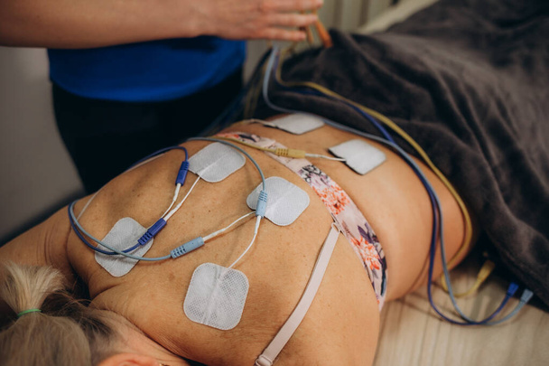 TENSの電極のパッドが付いているより低い背部物理療法,皮下の電気準備の刺激. 患者さんの背中への電極. 高品質の写真 - 写真・画像