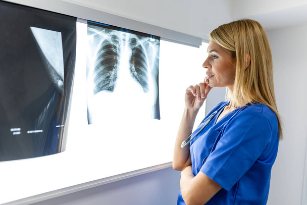放射線と医学のコンセプト。 スクリーン上の肺スキャン結果を上級患者に説明する医師. - 写真・画像