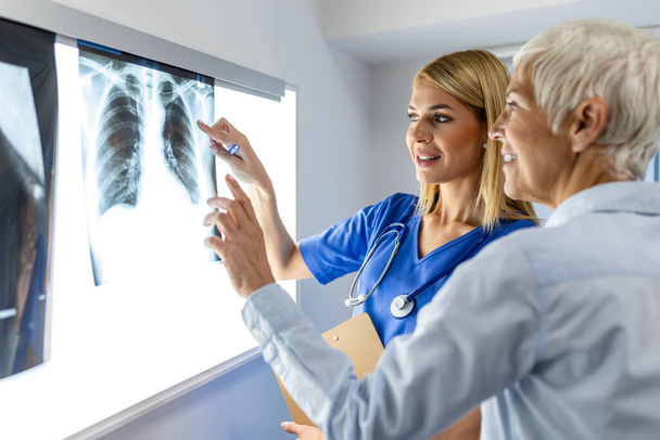 放射線と医学のコンセプト。 スクリーン上の肺スキャン結果を上級患者に説明する医師. - 写真・画像